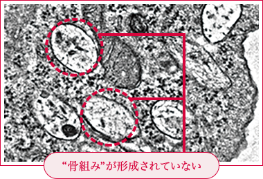 “骨組み”が形成されていない